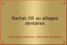 rachat or dentaire, alliages dentaires